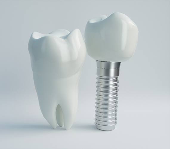 Closeup of model tooth next to dental implant in Fort Worth for comparison 