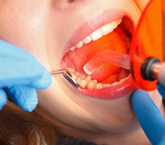 Patient receiving cosmetic dental bonding treatment