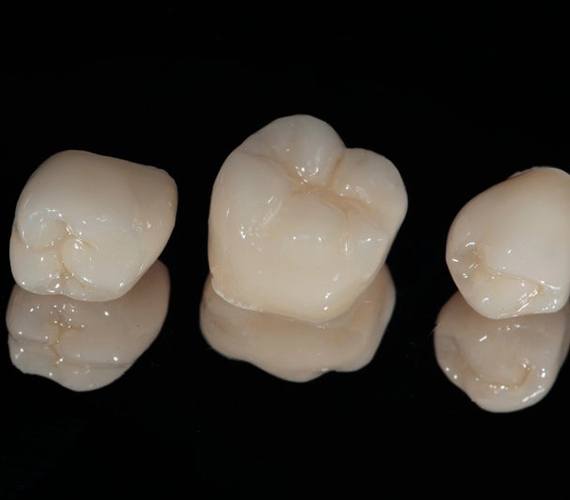 Dental crowns