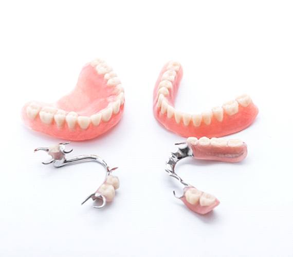 Full dentures for upper and lower arch next to partial dentures