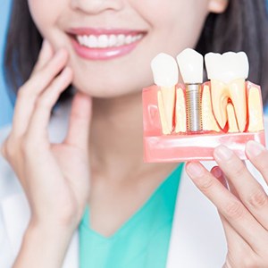 dentist holding a model of a dental implant 