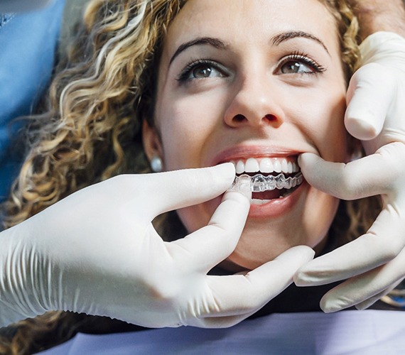 Dentist putting in clear aligners for patient