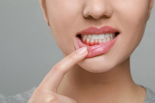 Protect your teeth and gums with gum disease treatment near Benbrook
