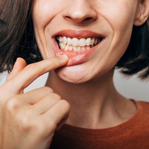 a woman showing her teeth and gums