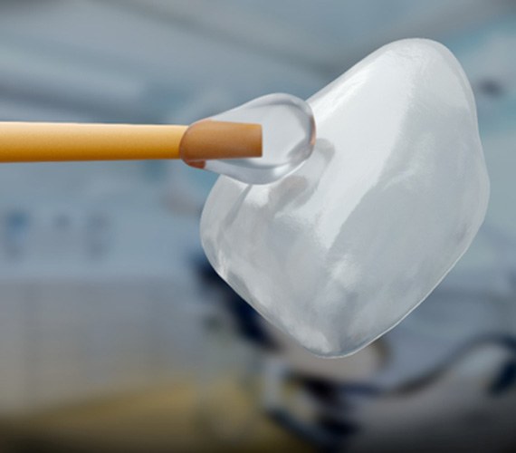 A closeup of a dental veneer with an applicator