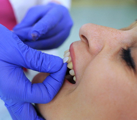 A woman receiving veneers in Fort Worth